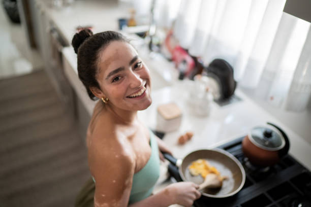 Diet Sehat untuk Penderita Vitiligo Makanan yang Perlu Diperhatikan